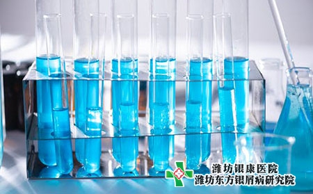 牛皮癣复发的原因有哪些?为什么会脱发? 牛皮癣复发的原因有哪些?为什么会脱发?