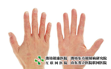 2 (281) 2 (281)
