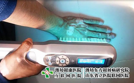 2 (200)光疗