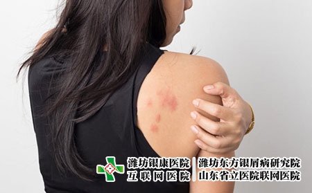 肩膀 症状