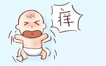 银屑病应该怎么治疗好