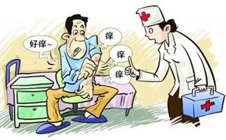 银屑病的治疗方法有什么