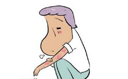 关节型银屑病的症状有什么