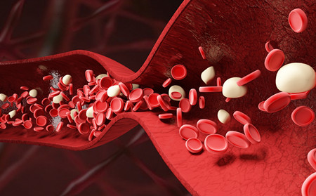 潍坊银康医院,潍坊选择治银屑病医院