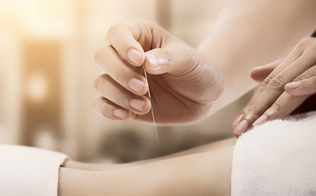 银屑病早期病因,早期银屑病病因