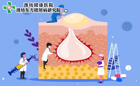 银屑病病因,冬季银屑病发病原因