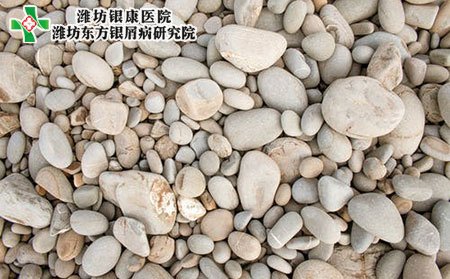 预防银屑病的方法有哪些?