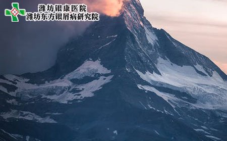 银屑病会传染吗?需要多久?